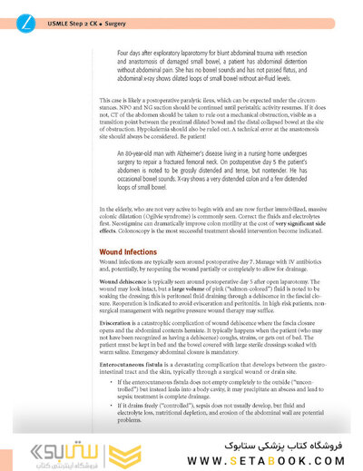 USMLE Step 2 CK Lecture Notes 2022: Surgery