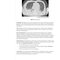 USMLE Step 2 CK Lecture Notes 2022: Surgery