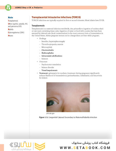 USMLE Step 2 CK Lecture Notes 2022: Pediatrics