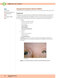 USMLE Step 2 CK Lecture Notes 2022: Pediatrics