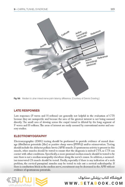Easy EMG : A Guide to Performing Nerve Conduction Studies and Electromyography