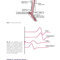 Easy EMG : A Guide to Performing Nerve Conduction Studies and Electromyography