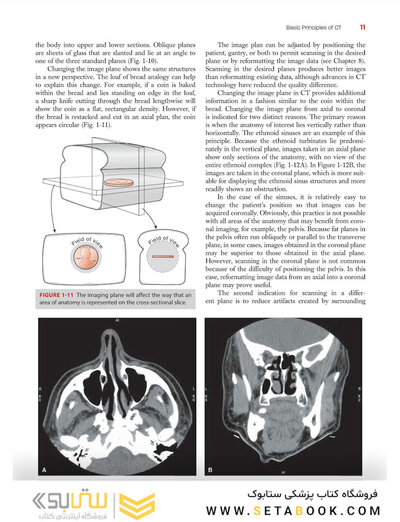 Computed Tomography for Technologists: A Comprehensive Text 2nd Edicion