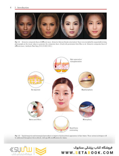Aesthetic Plastic Surgery of the East Asian Face