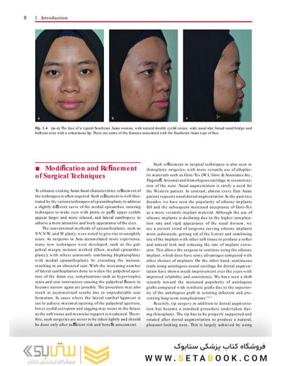 Aesthetic Plastic Surgery of the East Asian Face