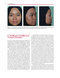 Aesthetic Plastic Surgery of the East Asian Face