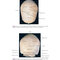 Atlas of Oral and Maxillofacial Surgery