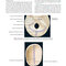 Atlas of Oral and Maxillofacial Surgery