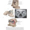 Atlas of Oral and Maxillofacial Surgery