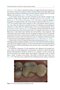 Material-Tissue Interfacial Phenomena : Contributions from Dental and Craniofacial Reconstructions 2017