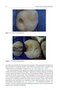 Material-Tissue Interfacial Phenomena : Contributions from Dental and Craniofacial Reconstructions 2017