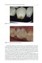 Material-Tissue Interfacial Phenomena : Contributions from Dental and Craniofacial Reconstructions 2017