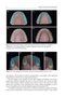 Material-Tissue Interfacial Phenomena : Contributions from Dental and Craniofacial Reconstructions 2017