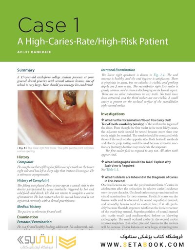 Odell's Clinical Problem Solving in Dentistry