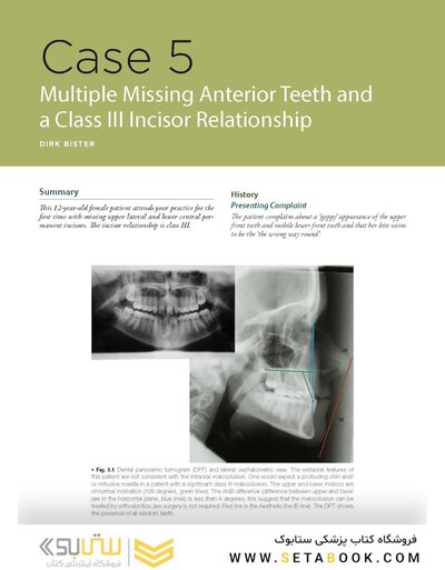 Odell's Clinical Problem Solving in Dentistry