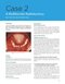 Odell's Clinical Problem Solving in Dentistry