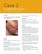 Odell's Clinical Problem Solving in Dentistry