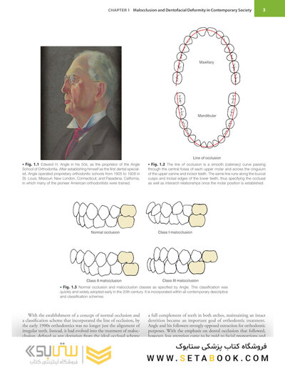 Contemporary Orthodontics