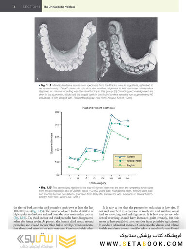 Contemporary Orthodontics