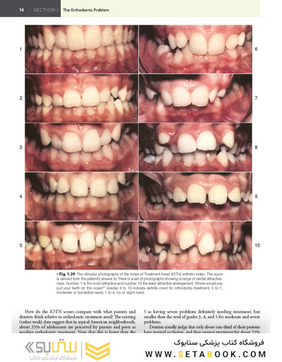 Contemporary Orthodontics