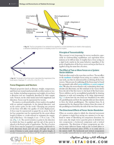 Temporary Anchorage Devices in Orthodontics 2nd Edition 2021