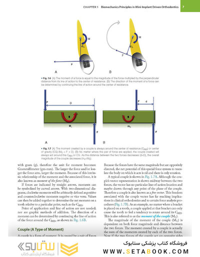 Temporary Anchorage Devices in Orthodontics 2nd Edition 2021