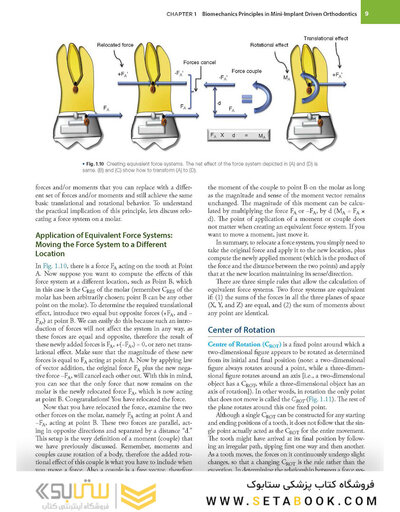 Temporary Anchorage Devices in Orthodontics 2nd Edition 2021