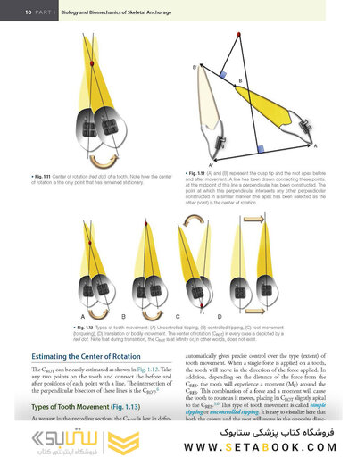 Temporary Anchorage Devices in Orthodontics 2nd Edition 2021