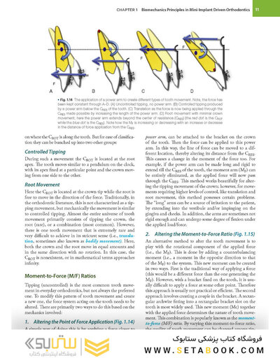 Temporary Anchorage Devices in Orthodontics 2nd Edition 2021