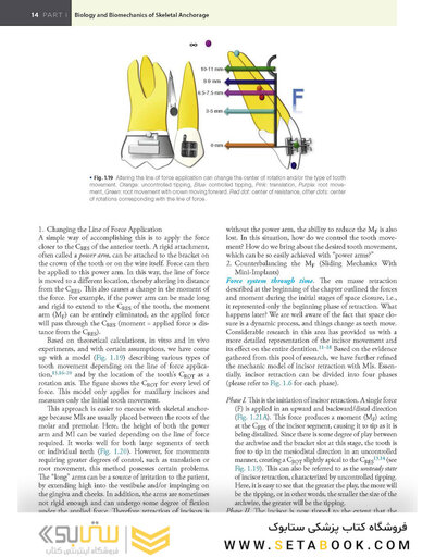 Temporary Anchorage Devices in Orthodontics 2nd Edition 2021