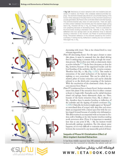 Temporary Anchorage Devices in Orthodontics 2nd Edition 2021