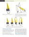 Temporary Anchorage Devices in Orthodontics 2nd Edition 2021