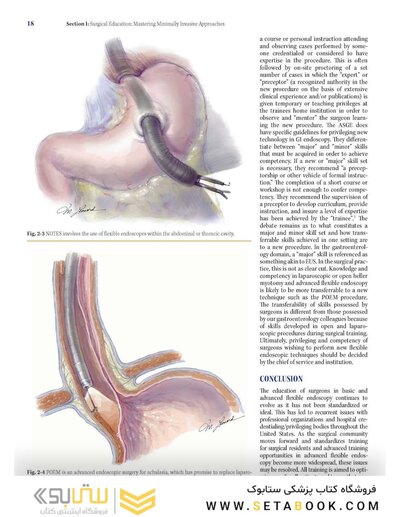 Mastery of Endoscopic and Laparoscopic Surgery Fourth Edition
