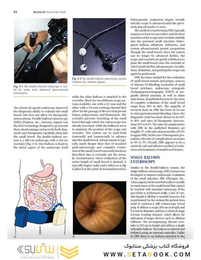Mastery of Endoscopic and Laparoscopic Surgery Fourth Edition
