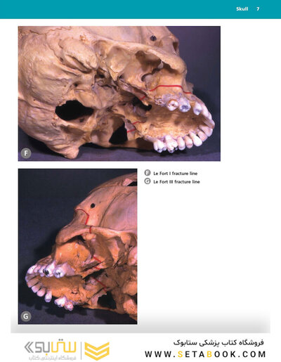 McMinn's Color Atlas of Head and Neck Anatomy