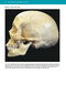 McMinn's Color Atlas of Head and Neck Anatomy