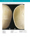 McMinn's Color Atlas of Head and Neck Anatomy