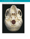 McMinn's Color Atlas of Head and Neck Anatomy