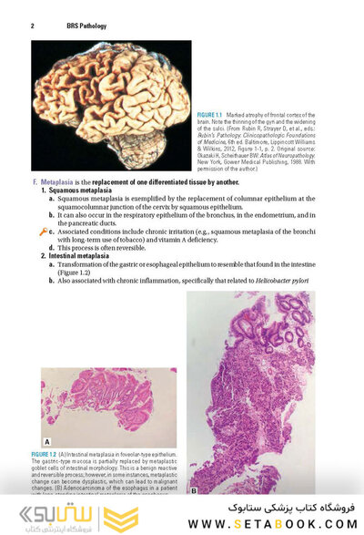 BRS Pathology 6th Edicion 2021