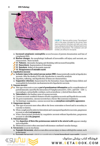 BRS Pathology 6th Edicion 2021