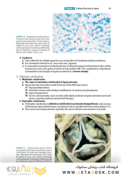 BRS Pathology 6th Edicion 2021