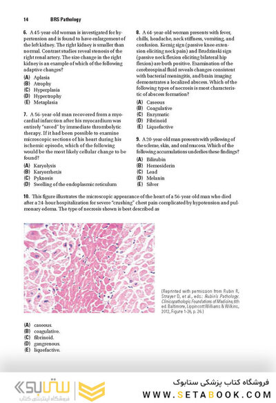 BRS Pathology 6th Edicion 2021
