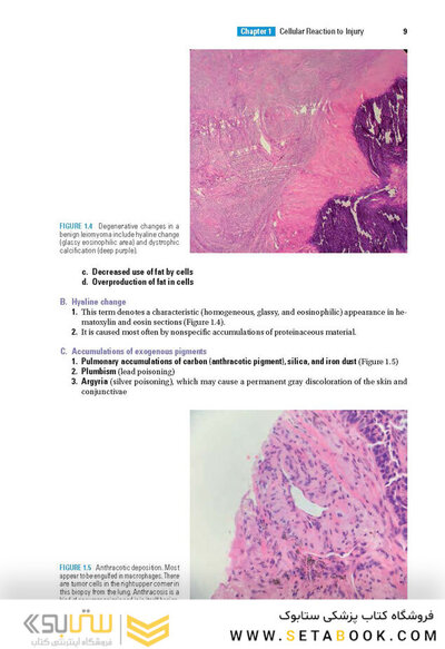 BRS Pathology 6th Edicion 2021