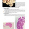 BRS Pathology 6th Edicion 2021