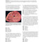 BRS Pathology 6th Edicion 2021