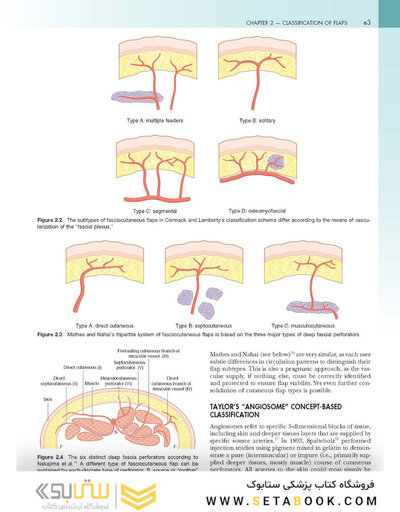 Flaps and Reconstructive Surgery 2nd Edition