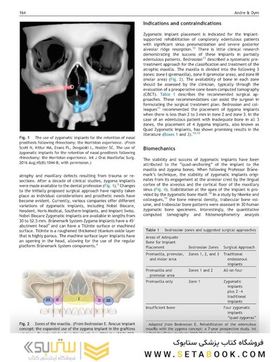 Perspectives on Zygomatic Implants, An Issue of Atlas of the Oral & Maxillofacial Surgery Clinics: Volume 29-2