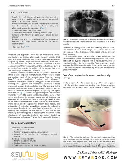 Perspectives on Zygomatic Implants, An Issue of Atlas of the Oral & Maxillofacial Surgery Clinics: Volume 29-2