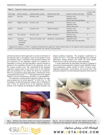 Perspectives on Zygomatic Implants, An Issue of Atlas of the Oral & Maxillofacial Surgery Clinics: Volume 29-2