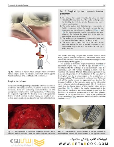 Perspectives on Zygomatic Implants, An Issue of Atlas of the Oral & Maxillofacial Surgery Clinics: Volume 29-2